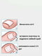 Набор для лечения вросшего ногтя (набор 5 в 1) | 6333866 | фото 2