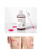 Пілінг-сироватка для обличчя Toxheal Red Glycolic Peeling Serum E100 мл | 6731886 | фото 2