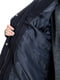 Жіноча куртка XXL чорний Хuechenhan ЦБ-00223819 | 6842218 | фото 6